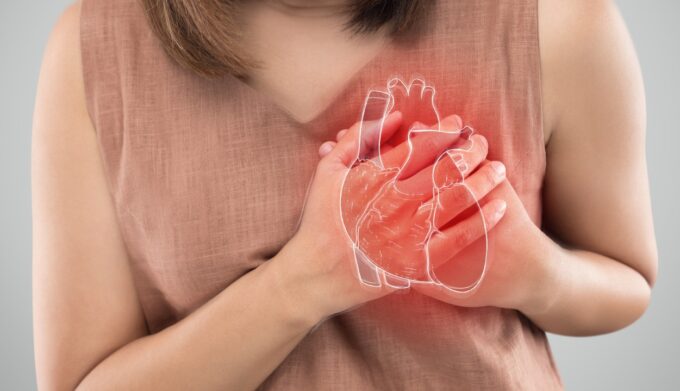 ပြင်းထန်သောနှလုံးချို့ယွင်းခြင်း (သို့) နှလုံးရပ်ခြင်း။