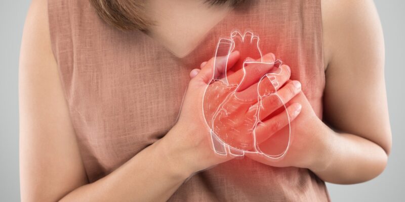 ပြင်းထန်သောနှလုံးချို့ယွင်းခြင်း (သို့) နှလုံးရပ်ခြင်း။